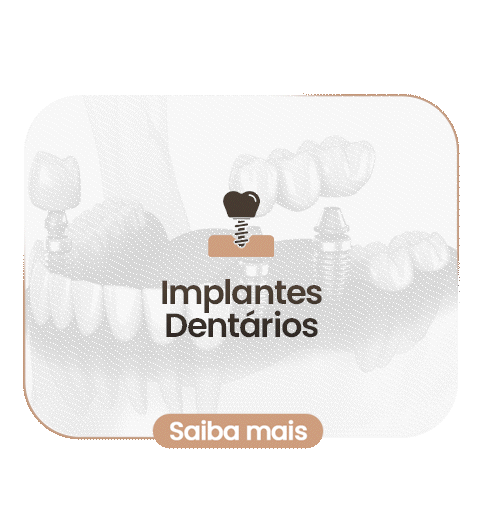 Sorriso com lentes de porcelana — caso da Clínica Eduardo Gama, São José dos Campos
