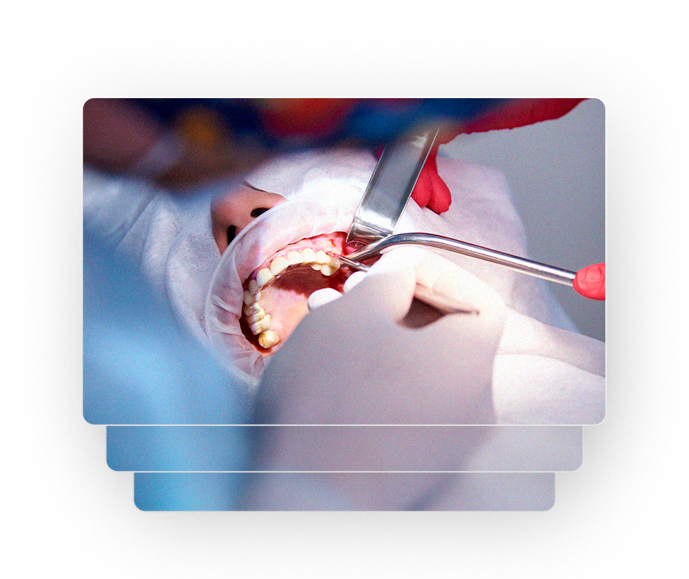 Procedimentos cirúrgicos odontológicos — Clínica Eduardo Gama, São José dos Campos