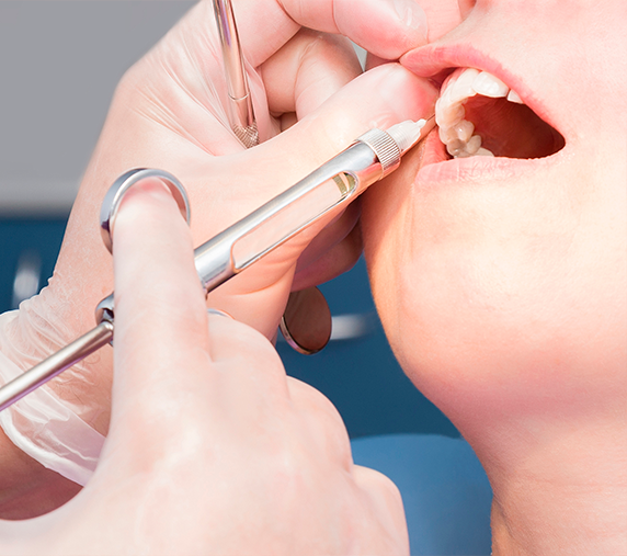 Procedimentos cirúrgicos odontológicos — Clínica Eduardo Gama, São José dos Campos