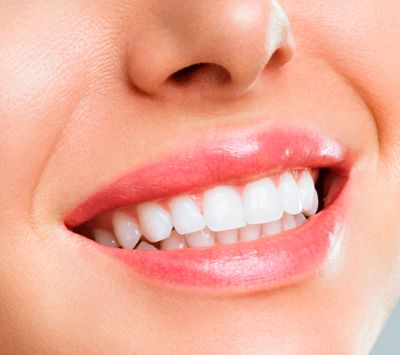 Lentes de contato dental de porcelana — Dr. Eduardo Gama, São José dos Campos